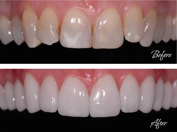 Mont Blanc Center For Dentistry