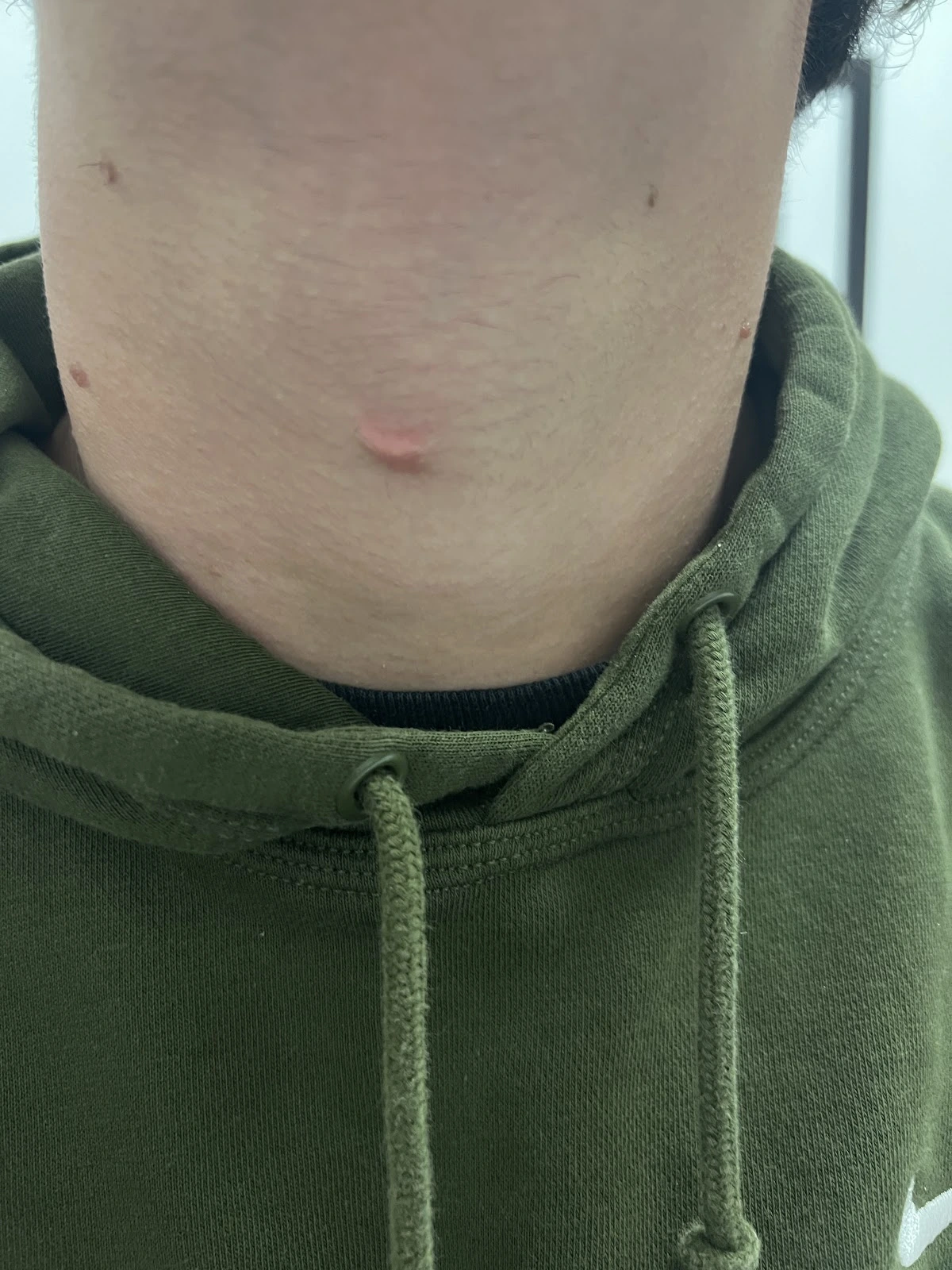 Jordan Valley Dermatology