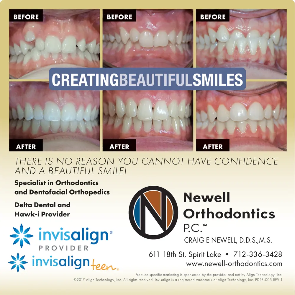 Orthodontics and Invisalign in Spirit Lake, Iowa